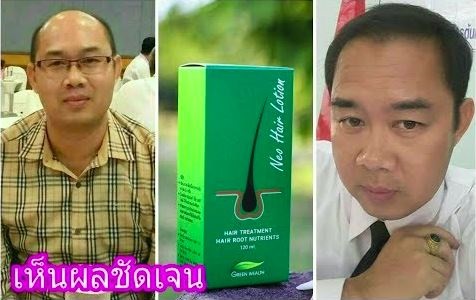 ยาปลูกผมนีโอแฮร์