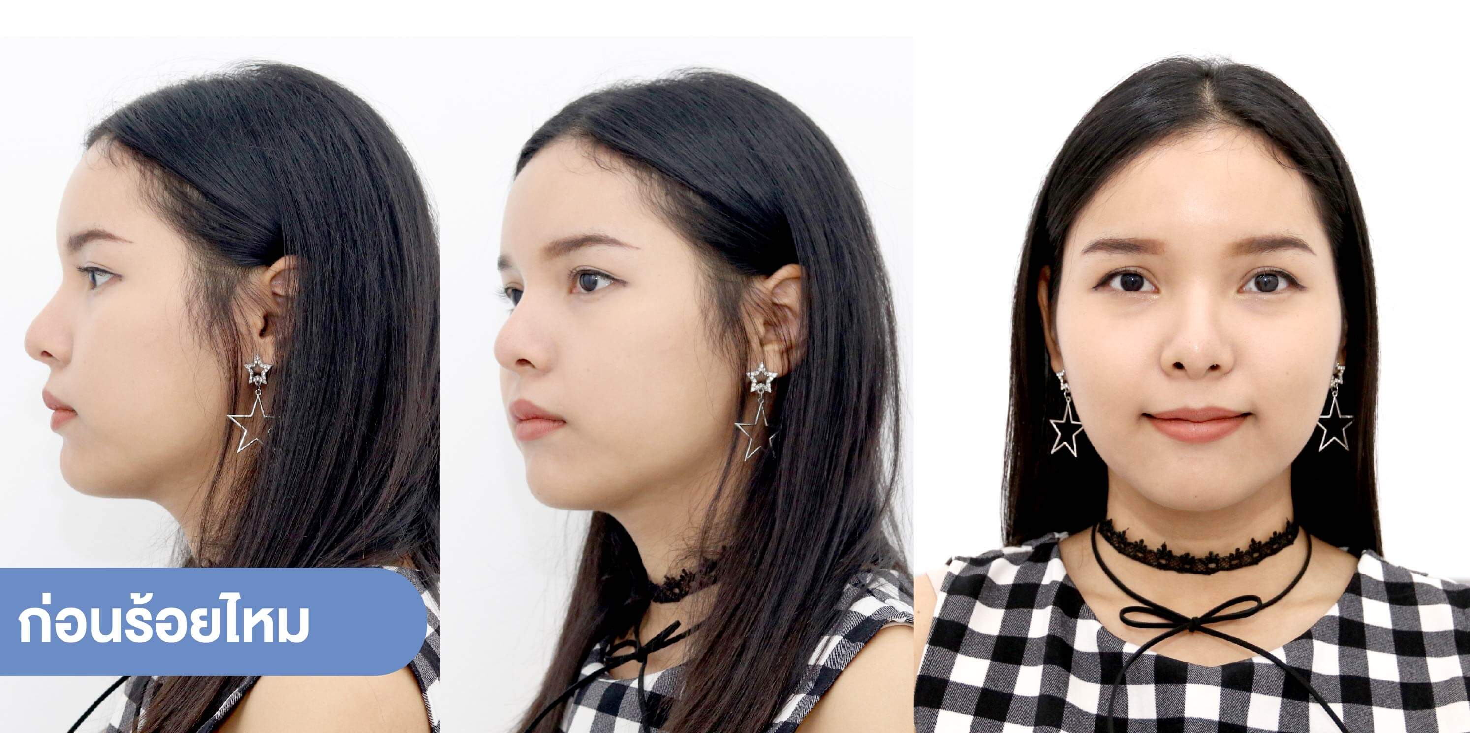 ก่อนร้อยไหม-รีวิว