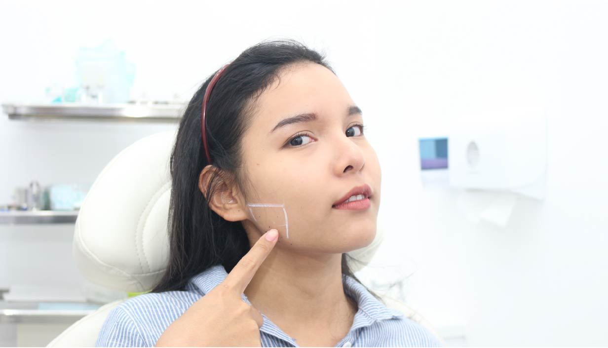 โบท็อกลดกราม