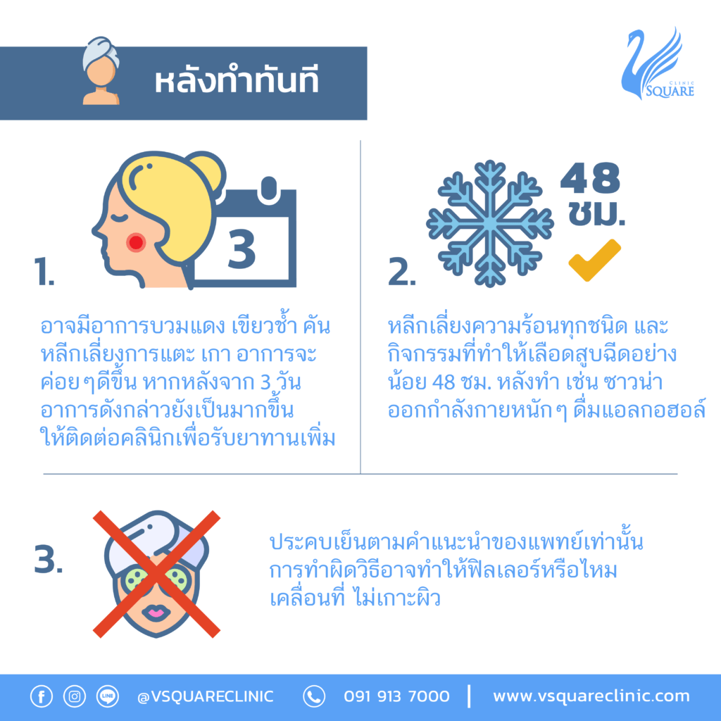 ข้อปฎิบัติหลังฉีดฟิลเลอร์ปาก1