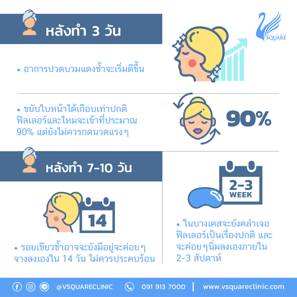 ข้อปฎิบัติหลังฉีดฟิลเลอร์ปาก