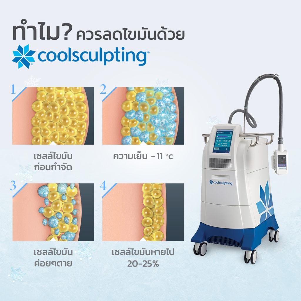 ทำไมควรลดไขมันด้วย-Coolsculpting