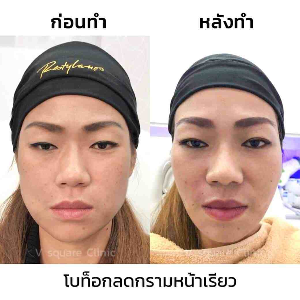 รีวิวโบท็อก