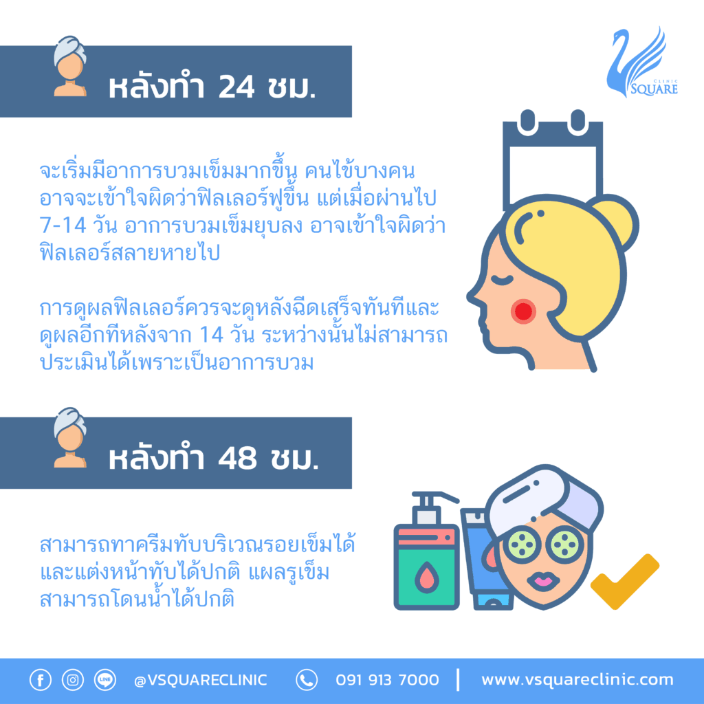 ข้อปฎิบัติหลังฉีดฟิลเลอร์_หลังทำ24-48ชม