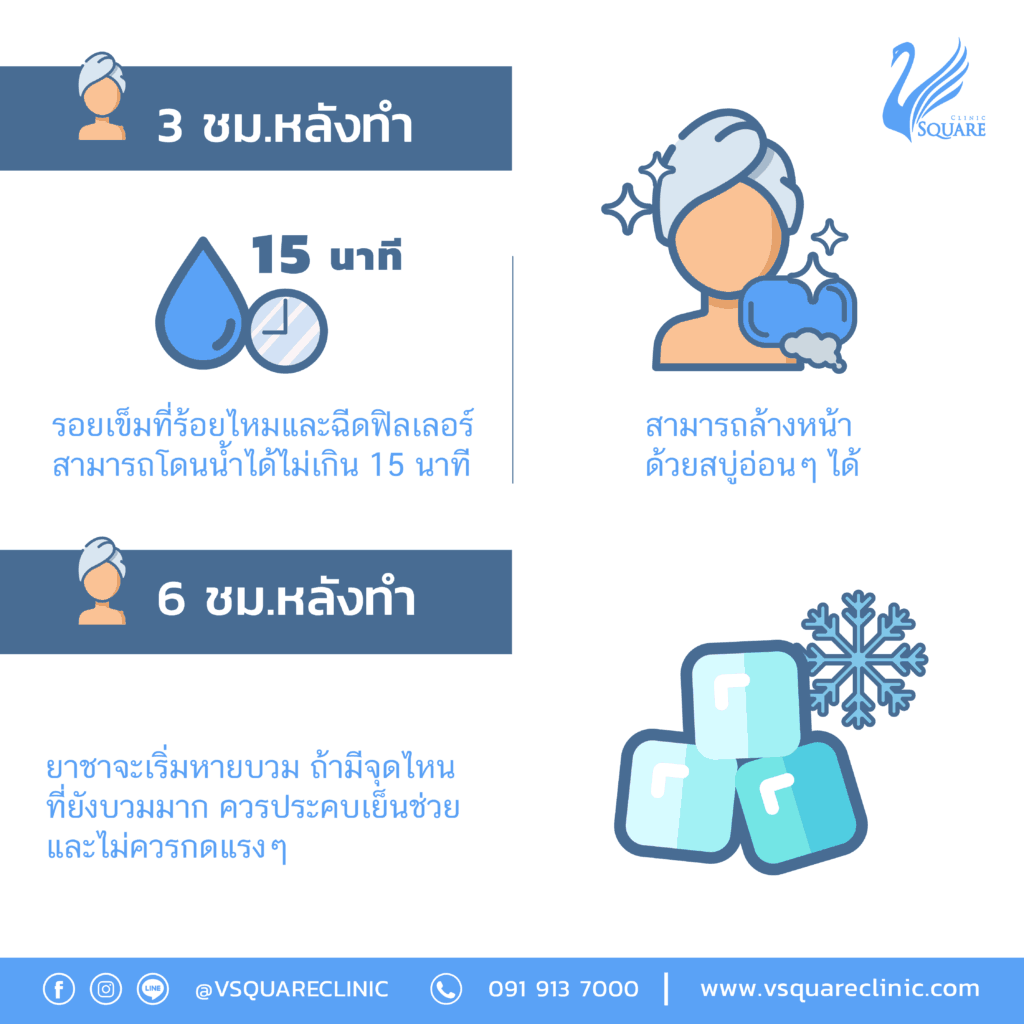 ข้อปฎิบัติหลังฉีดฟิลเลอร์_หลังทำ3-6ชม