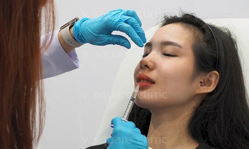 ฉีดฟิลเลอร์ปาก ใช้เทคนิคอย่างไร